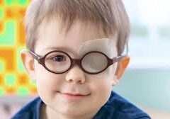 Ojo vago en la infancia: ¿Un factor de riesgo para enfermedades cardíacas en la adultez?